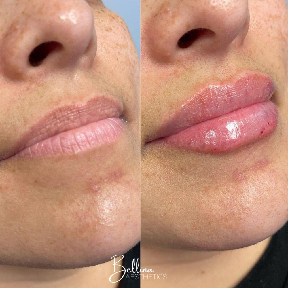 Bellina Medical Aesthetics